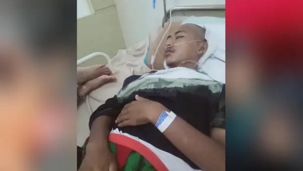 Remaja penderita kanker otak warga Cibitung Kabupaten Sukabumi | Foto : Istimewa