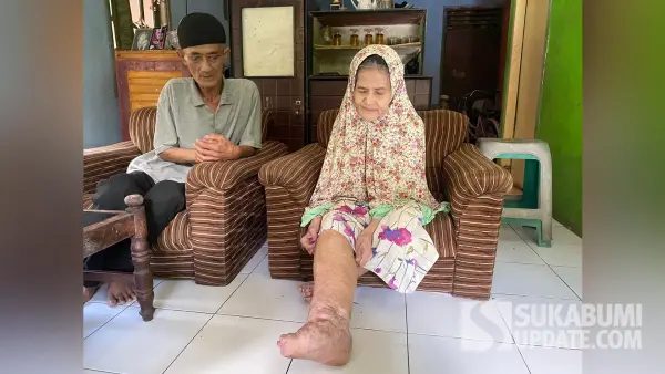 Tuti,lansia di Cisaat Sukabumi saat menunjukkan kondisi kakinya yang membengkak akibat penyakit yang dideritanya bertahun-tahun. (Sumber Foto: SU/Asep Awaludin)