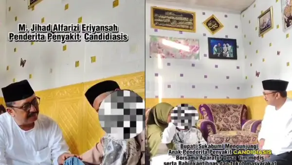 Bupati Sukabumi Asep Japar saat mengunjungi M. Zihad Alfaritsi Eriansyah (7 tahun), bocah penderita Candidiasis di kediamannya di Kampung Kubang RT 17/04, Desa Pasir Datar Indah, Kec. Caringin | Foto : Facebook @Asep Japar Asjap