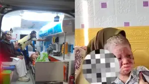 M Zihad Alfaritsi saat menuju RSCM Jakarta didampingi perawat RSUD Sekarwangi dan keluarga | Foto : Dokpim