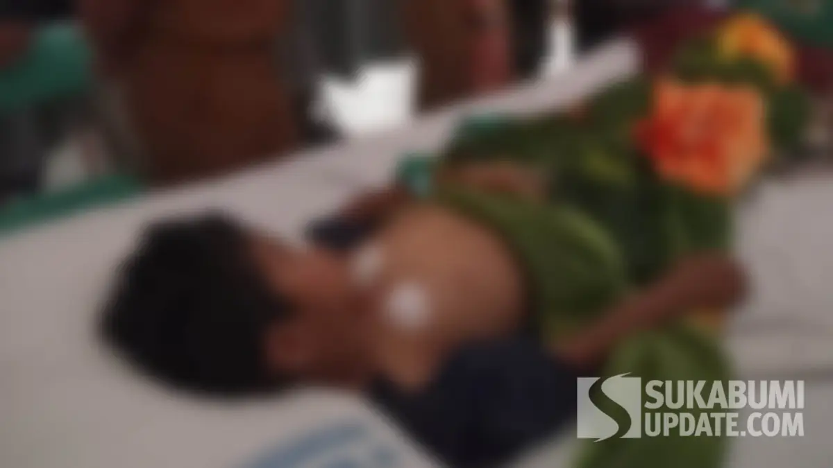 Jalani Operasi Mata, Siswa SD di Sagaranten Sukabumi Diduga Berkelahi usai Dibully Teman Sekelas
