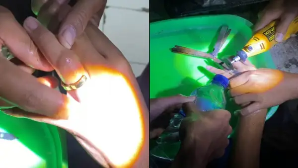 Petugas Damkar saat proses pelepasan cincin yang macet di jari seorang anak warga Margaluyu, Sukaraja, Kabupaten Sukabumi | Foto : Capture Video Damkar