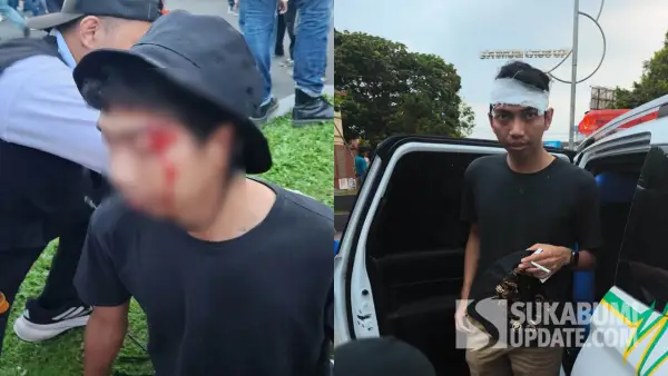 Dede Galib, seorang massa aksi 1 September 2025 Kota Sukabumi mengalami luka dikepala akibat terkena lemparan batu | Foto : Turangga Anom