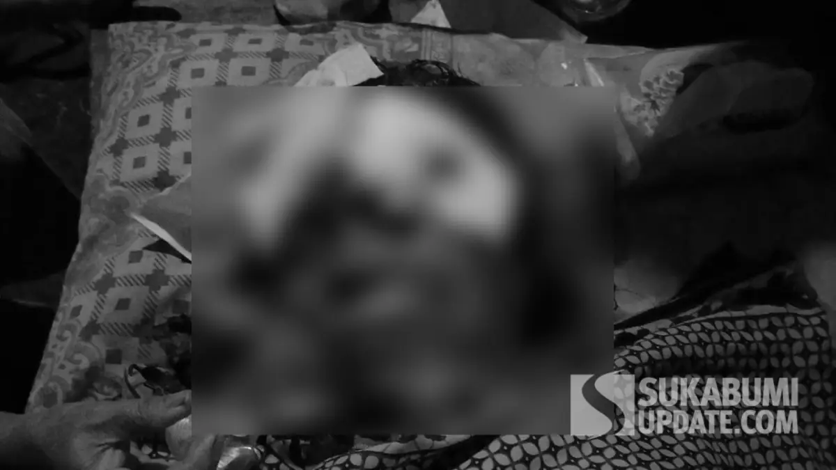 Kondisi IRT Cianjur Korban Amukan Suami Segera Ditangani Dokter Bedah di Sukabumi