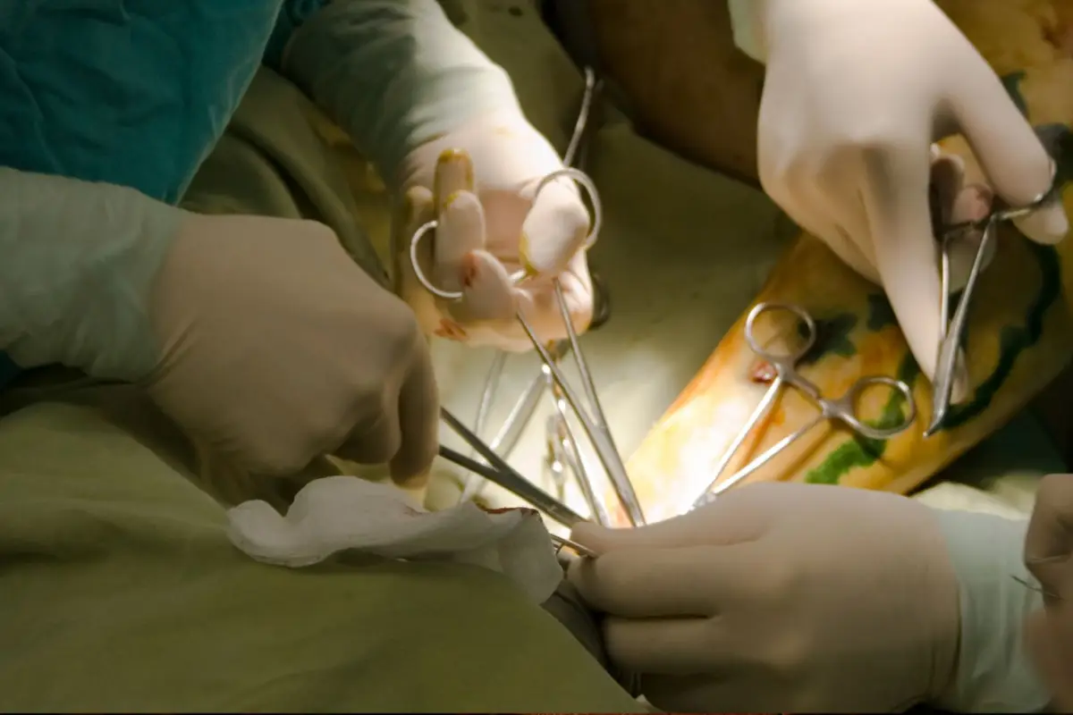 Tonio Treschi, seorang bangsawan muda Venesia yang dikhianati dan dikebiri paksa oleh saudaranya, harus menavigasi dunia opera yang memukau sebagai soprano dengan suara luar biasa, sekaligus bergumul dengan identitasnya yang hilang.