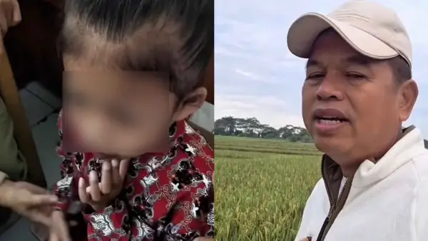 Kolase foto siswi SD di Sukabumi (kiri) yang tengah berjuang melawan penyakit jantung bocor dan penyumbatan pernapasan, serta Gubernur Jabar Dedi Mulyadi (kanan) yang merespons cepat kondisi Silvi. (Sumber Foto: Istimewa)