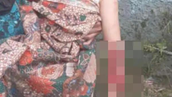 Bocah perempuan korban begal hp di Sukaraja Kabupaten Sukabumi (Sumber: dok warganet)