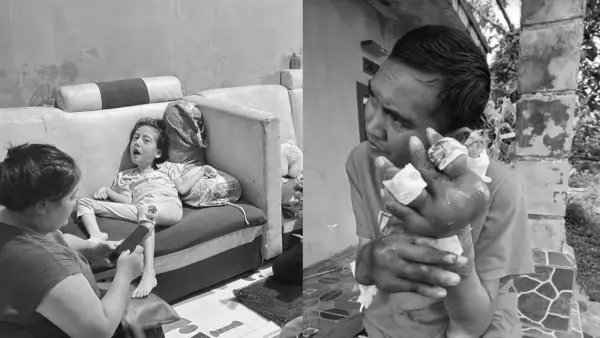 Dua kasus penyakit langka di Kecamatan Sukaraja dan Kabandungan, Kabupaten Sukabumi | Foto : Dok. warga