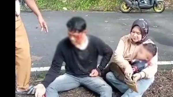 Suami istri boncengan motor terjatuh dan luka-luka usai menabrak kabel wifi yang menjuntai ke jalan di Waluran, Kabupaten Sukabumi | Foto : Dok.warga