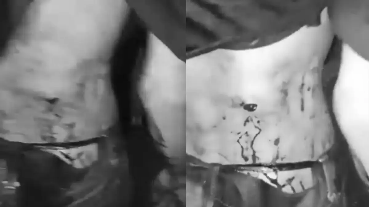 Pemuda Asal Cianjur Jadi Korban Pembacokan Berandal Motor di Curugkembar Sukabumi