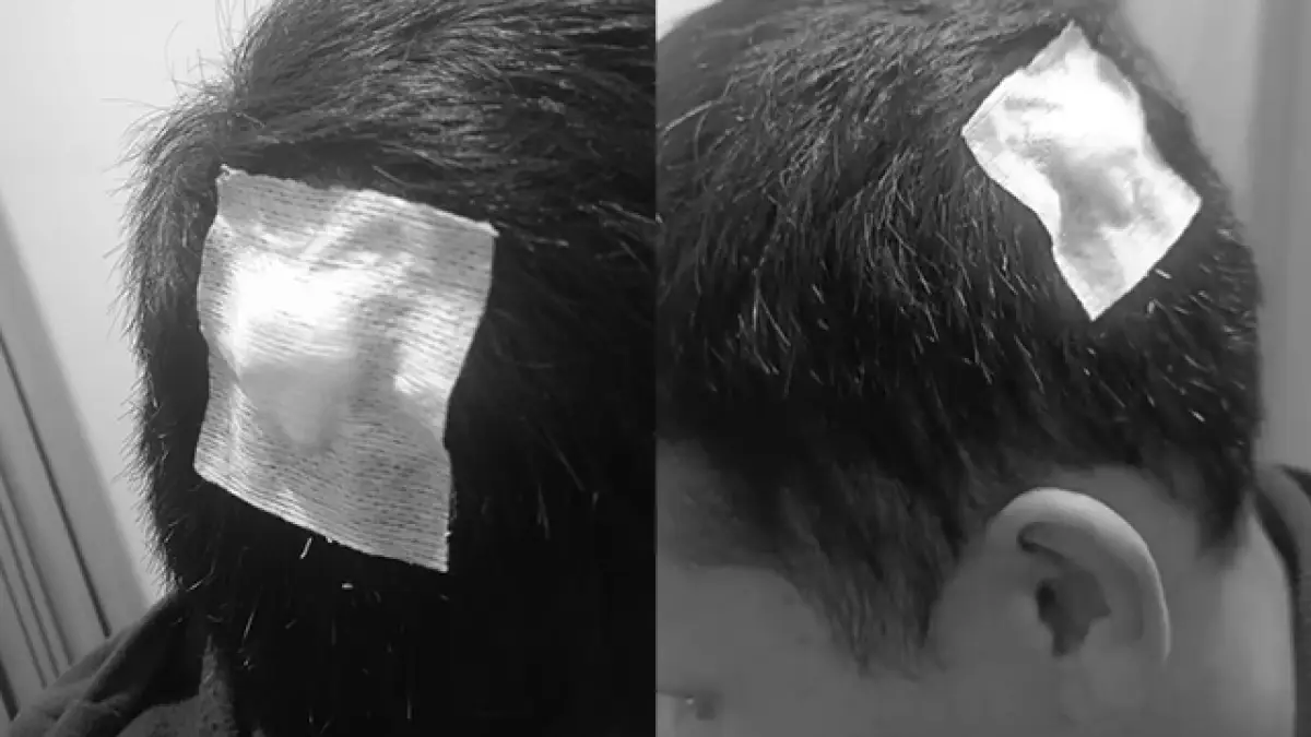 Sedang Nunggu Orderan, Ojol Dibacok dan Motornya Dirusak OTK di Cikole Sukabumi