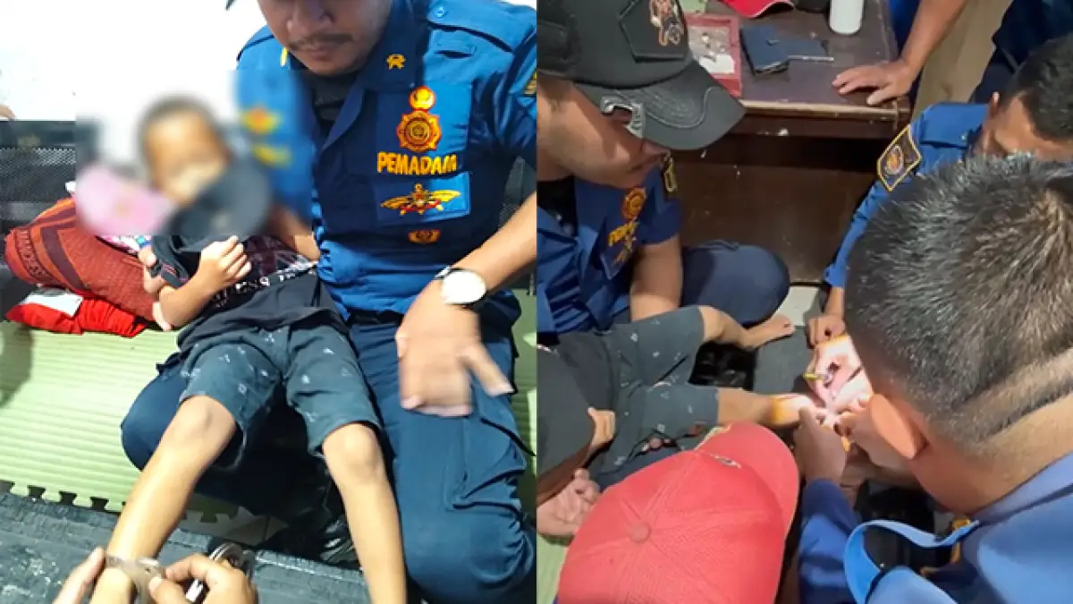 Pulang Main dari Sungai, Kaki Bocah 5 Tahun di Palabuhanratu Ini Tiba-tiba Terborgol
