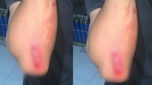 Konidis luka bacok 12 jahitan yang dialami remaja di Cisolok, Kabupaten Sukabumi | Foto : Dok. warga