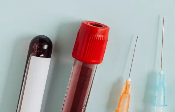 Ilustrasi Tak Hanya Faktor Genetik, Ini Penyebab Kanker Darah yang Jarang Disadari (Sumber : Freepik/@rawpixel.com)