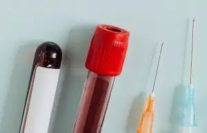 Ilustrasi Tak Hanya Faktor Genetik, Ini Penyebab Kanker Darah yang Jarang Disadari (Sumber : Freepik/@rawpixel.com)