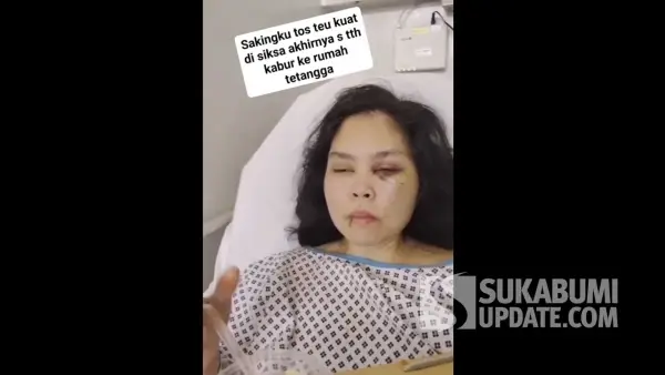 Kondisi memprihatinkan Dewi, PMI asal Tegalbuleud Sukabumi yang tengah dirawat di Dubai Uni Emirat Arab. (Sumber Foto: Tangkapan layar video)
