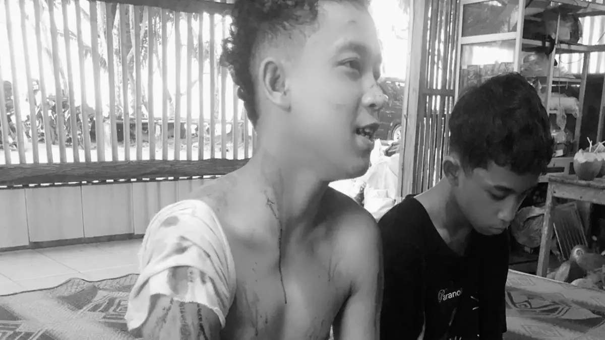 2 Wisatawan Asal Cianjur Jadi Korban Perampokan di Pantai Cibuaya, Satu Alami Luka Serius