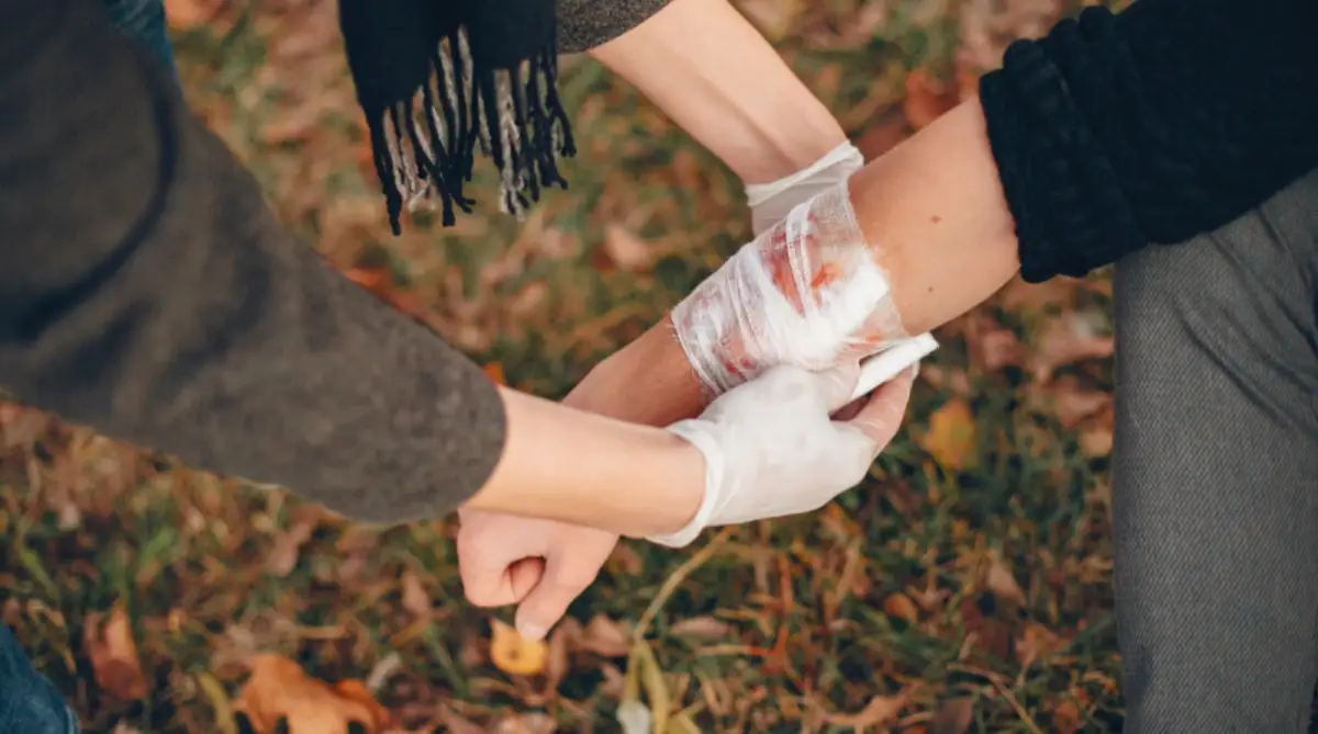 Cara Merawat Luka agar Tidak Berbekas, Ini Langkah yang Tepat!