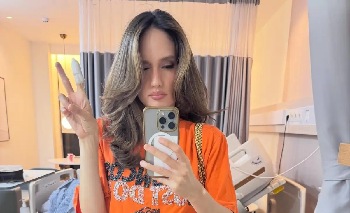 Tersayat hingga Tulang, Cinta Laura Jelaskan Luka Jarinya hingga Harus Dioperasi