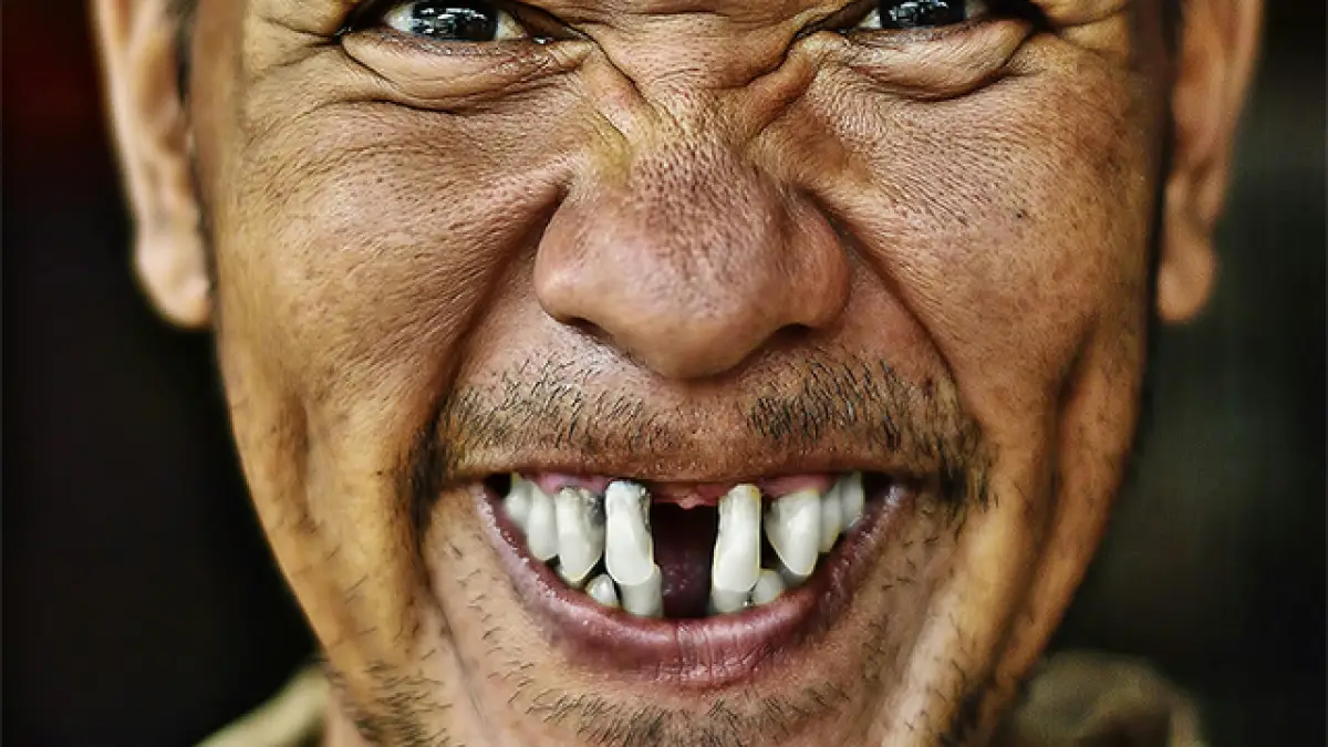 Gigi Kamu Bolong? Tenang, Jepang Lagi Bikin Obat Penumbuh Gigi Baru!