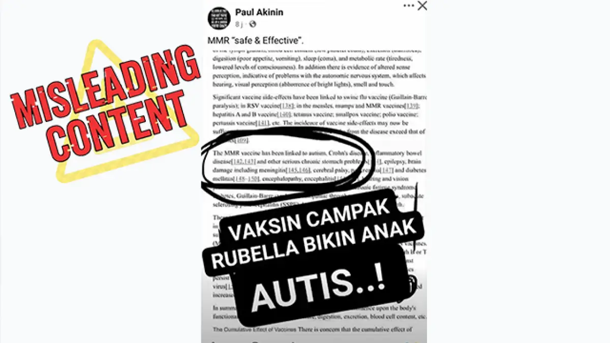 SALAH: Klaim Vaksin Campak Rubella Bisa Membuat Anak Menjadi Autis