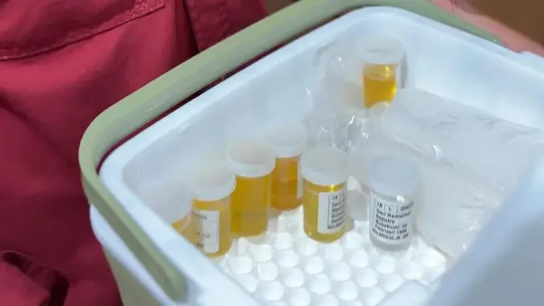 Hasil tes urine karyawan SPPG di Sukabumi. (Sumber: Istimewa)