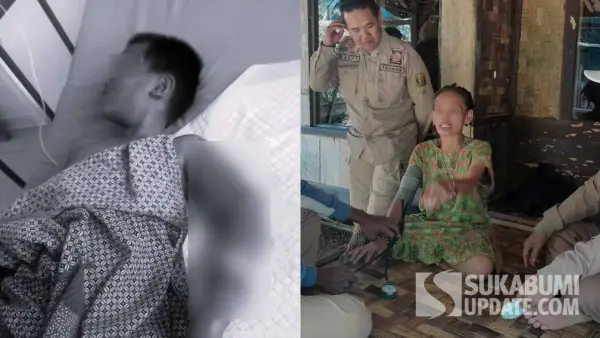 Bocah 11 tahun (kiri) di Waluran Sukabumi harus jalani operasi akibat luka bakar yang dialaminya pasca tersiram air panas dari bibinya (kanan) yang ODGJ. (Sumber Foto: Istimewa)