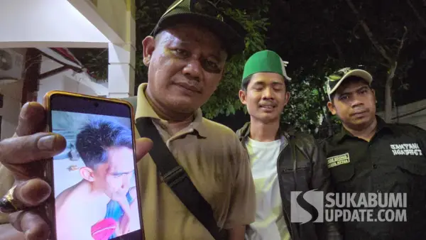 Roni Permana, kakak korban saat menunjukkan luka yang dialami korban dugaan penganiayaan kades di Sukabumi. (Sumber: SU/Ilyas Supendi)