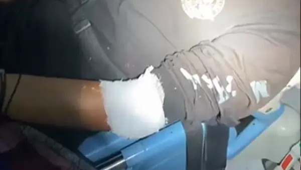 Pekerja tambal ban Dede (27) asal Nyalindung, Kabupaten Sukabumi yang menjadi korban pembacokan. (Sumber : Dok warga).