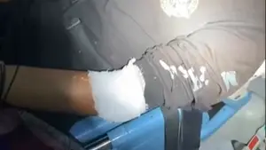 Pekerja tambal ban Dede (27) asal Nyalindung, Kabupaten Sukabumi yang menjadi korban pembacokan. (Sumber : Dok warga).