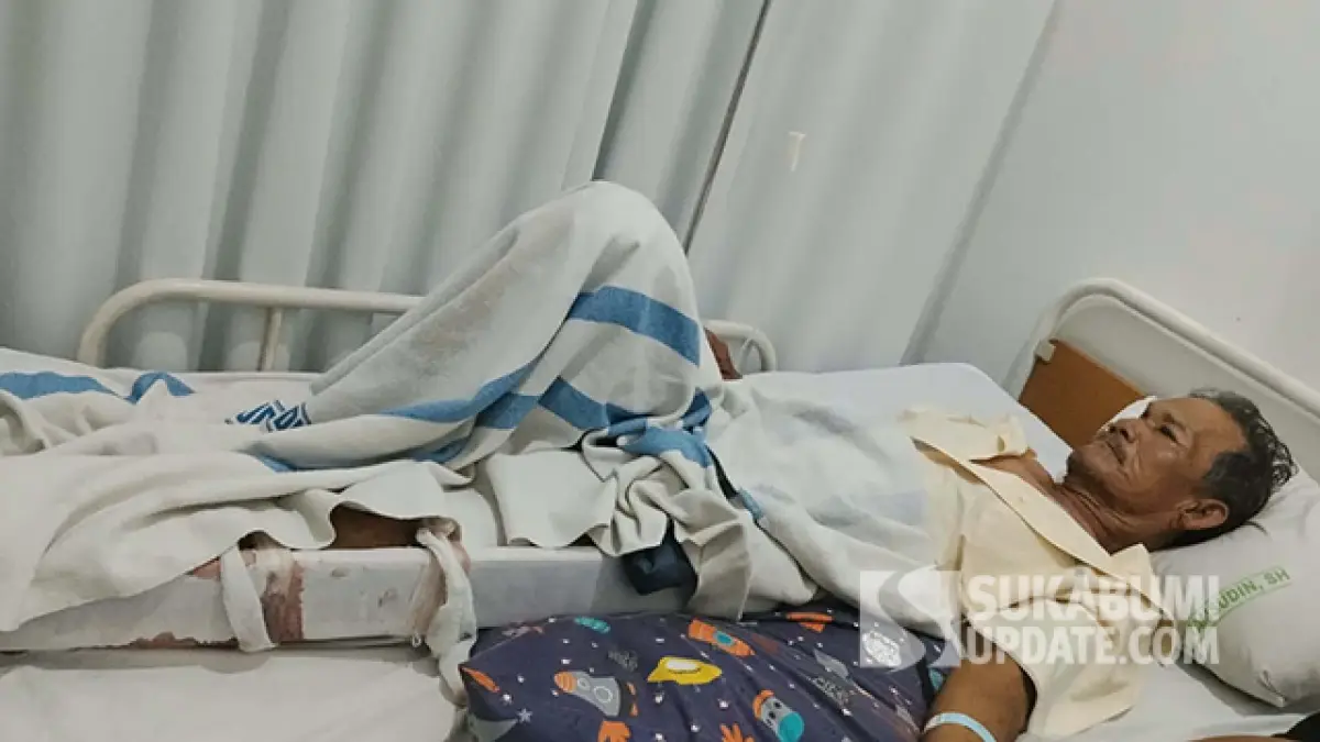 Kondisi Pedagang Es Korban Insiden Pelajar di Sukabumi, Penglihatan Mata Kanan Terancam Tak Normal