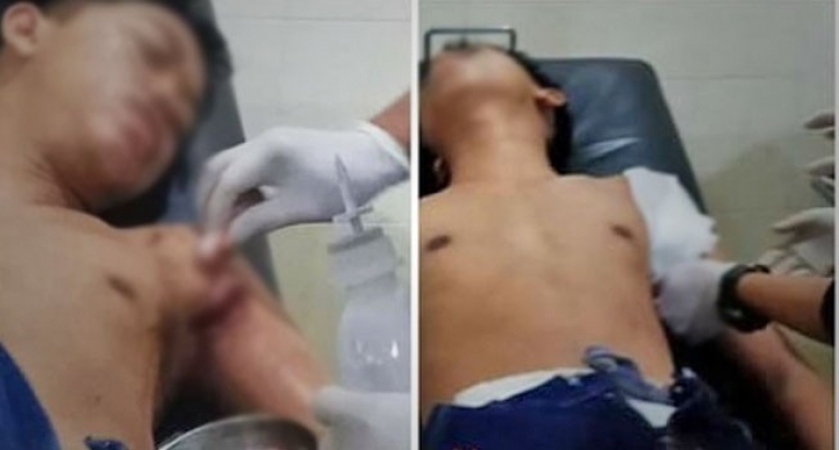 Geng Motor di Depok Kian Brutal, Dua Remaja Jadi Korban