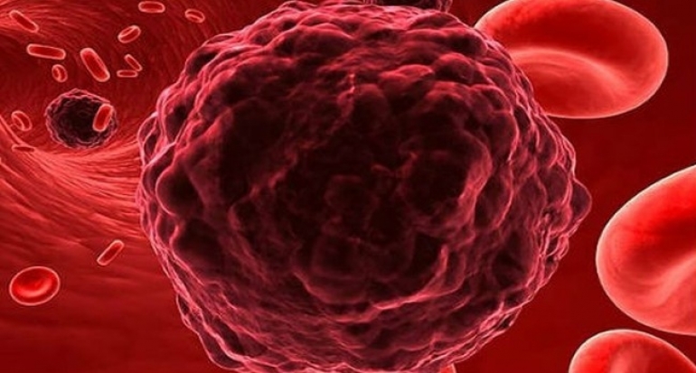 Peneliti Rusia Rancang Perangkat Unik Diagnosa Kanker