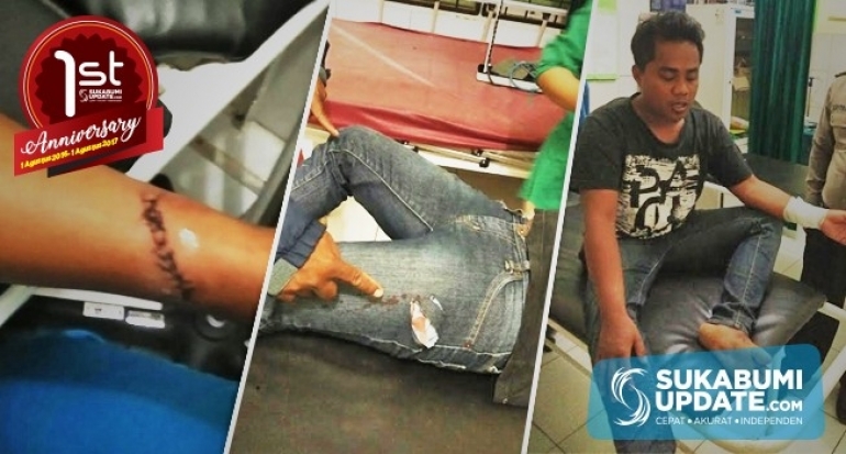 Dua Saudara Berselisih, Geri Warga Panyinangan Kabupaten Sukabumi Alami Luka Bacok